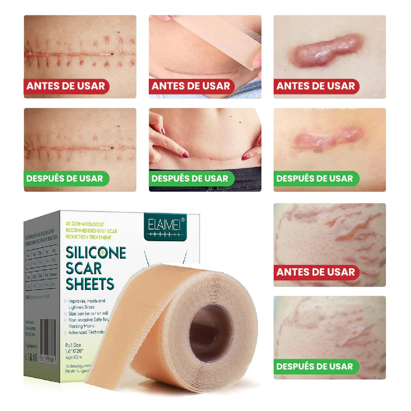 🌿Oferta Especial 2X1 En  Cinta Médica Elimina Cicatrices